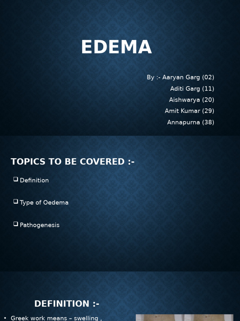 Understanding Edema: Types and Causes | PDF