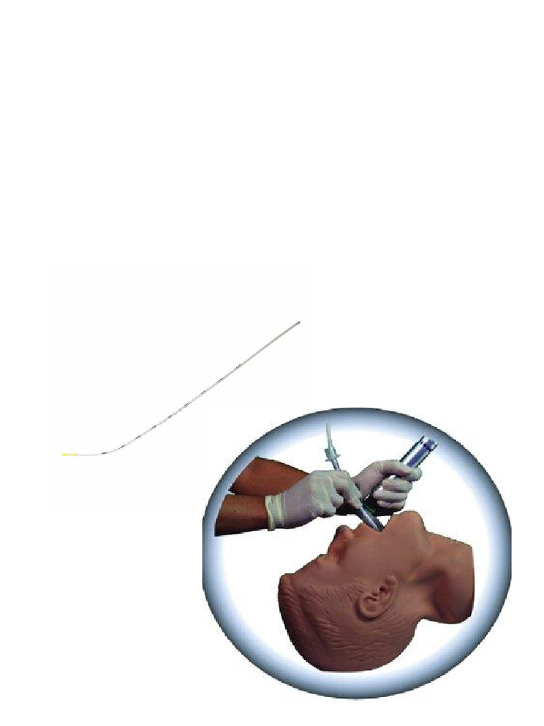 Bougie for Difficult Intubation Guide | PDF