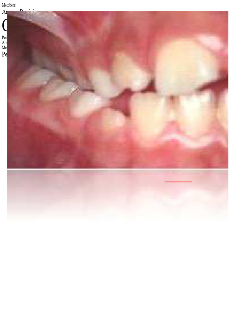 Understanding Posterior Crossbite Types | PDF | Dentistry Branches ...