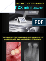 Odontometria Com Localizador Apical