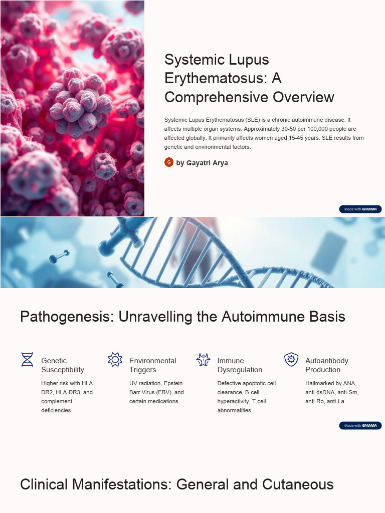 Systemic Lupus Erythematosus Overview | PDF | Immunology | Human ...