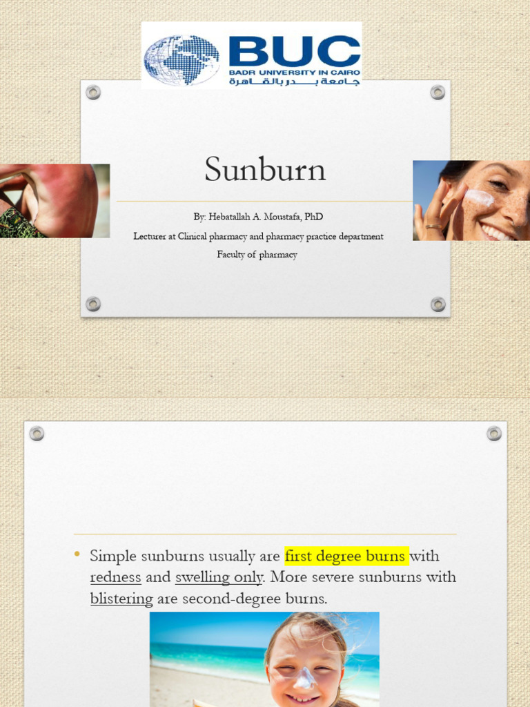 Understanding Sunburn: Risks and Prevention | PDF | Sunscreen | Ultraviolet
