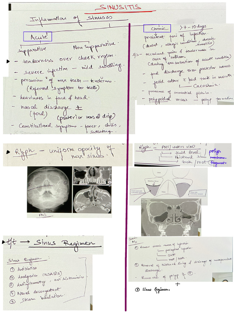 Sinusitis | PDF
