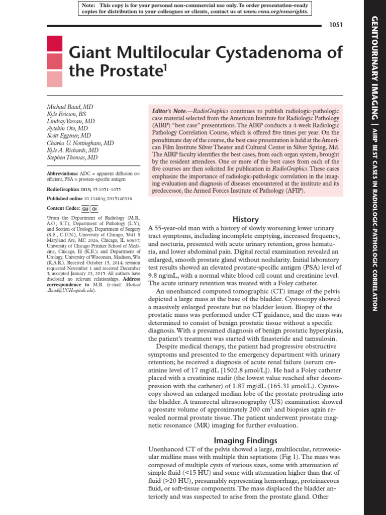 Cistoadenoma Multilocular Prostata | PDF | Epithelium | Prostate