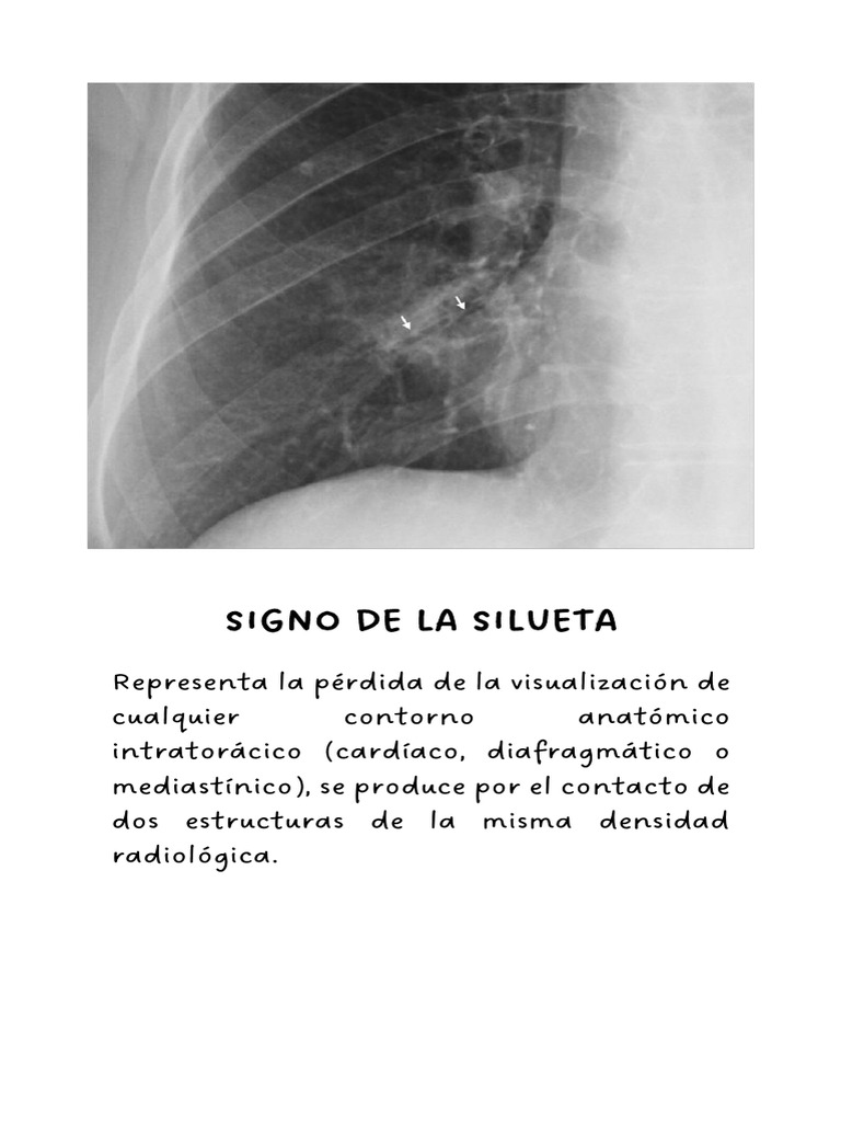 Signos Radiologicos Que Debes Saber | PDF | Pulmón | Corazón