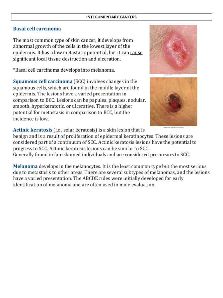 Integumentary Cancers and Aging Effects | PDF | Skin | Epidermis