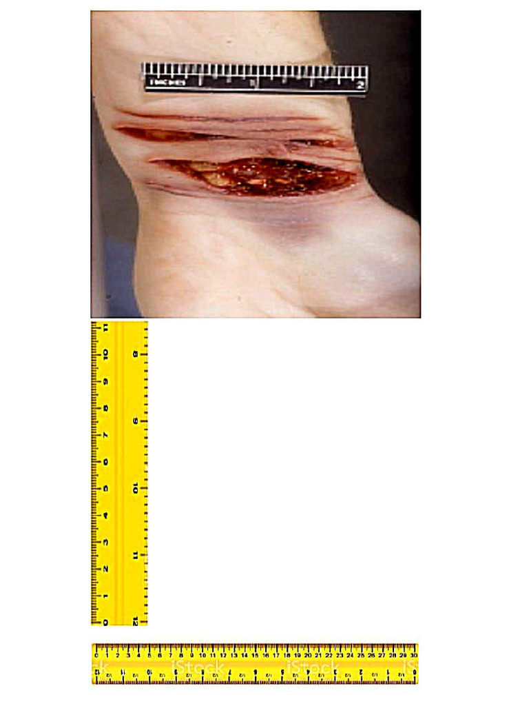 Wound Along With Descriptions | PDF