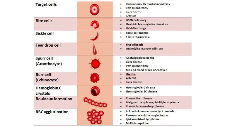 Morphology RBC | PDF