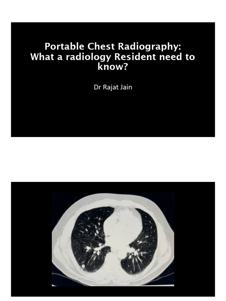 Portable Chest Radiography What a Radiology Reside 251216 092856 | PDF ...