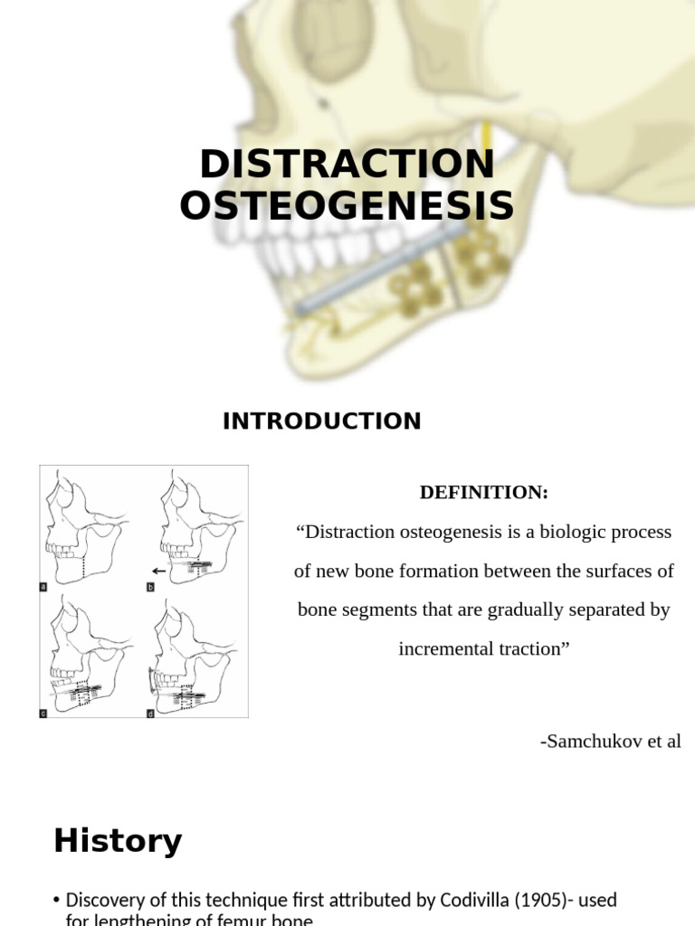 Distraction Osteogenesis: Techniques & Applications | PDF | Human Head ...