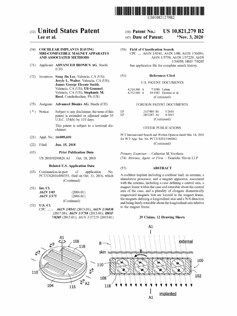 MRI-Compatible Cochlear Implant Patent | PDF | Implant (Medicine ...