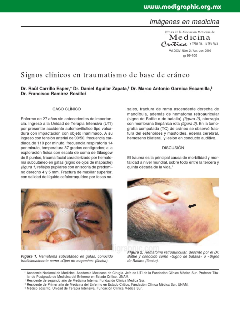 Signos clínicos de trauma craneal | PDF | Lesión | Medicina