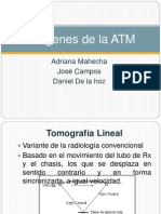 Articulacion Temporo Mandibular Imagenes