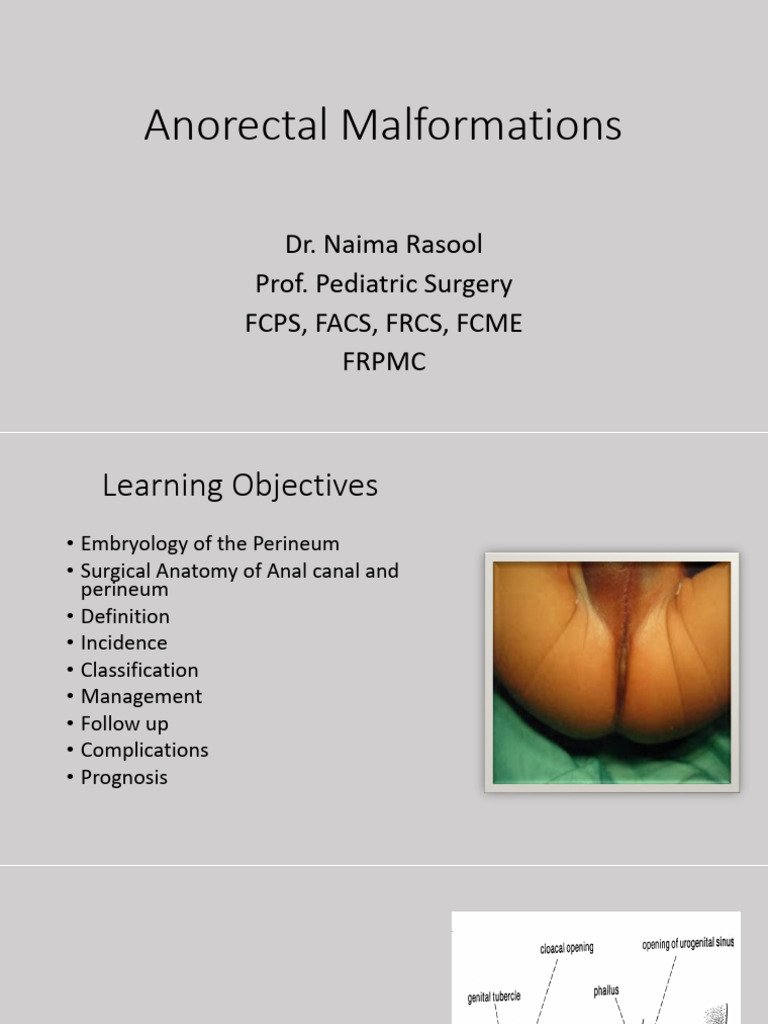 Anorectal Malformations Overview | PDF
