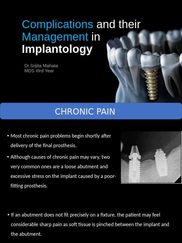 Implant Complications | PDF | Dental Implant | Health Sciences