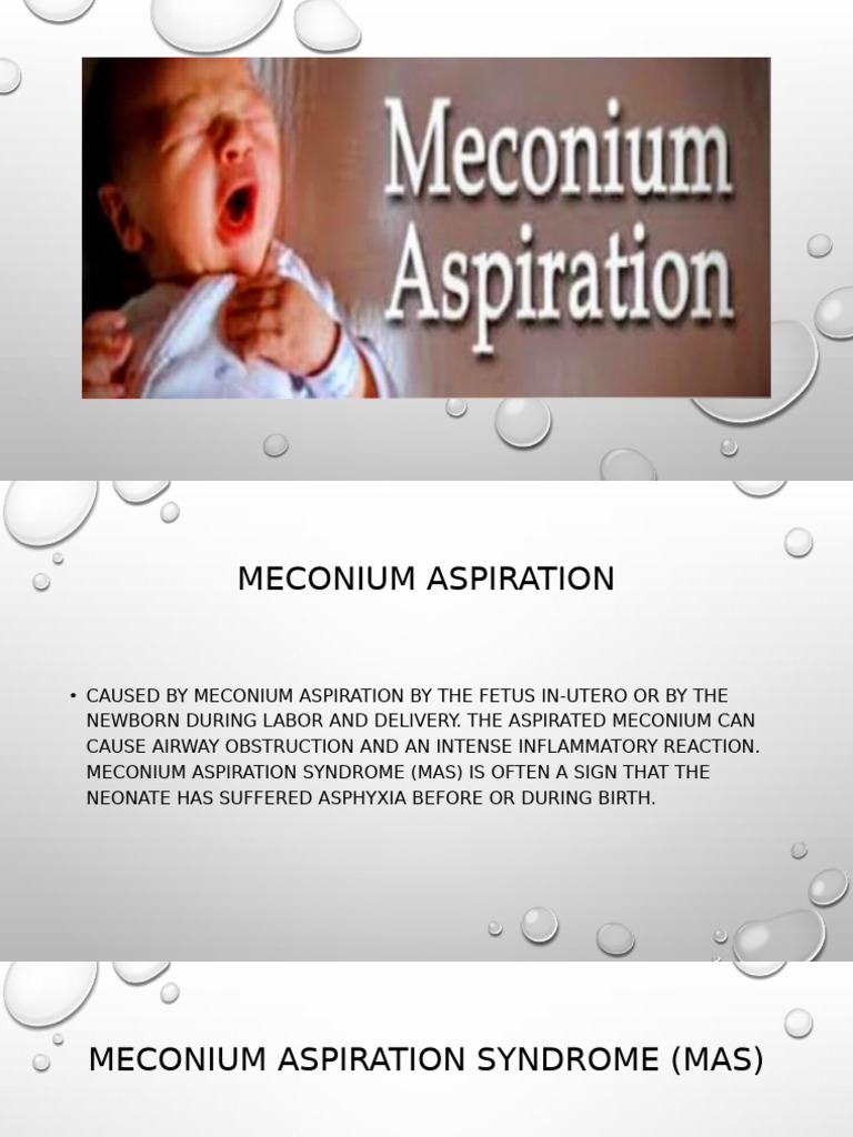 Meconium | PDF | Clinical Medicine | Medical Specialties