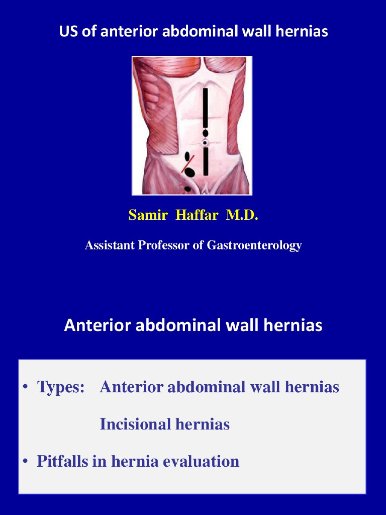 Abdominal Wall Hernias - 1 | PDF