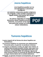 Tumores Hepáticos