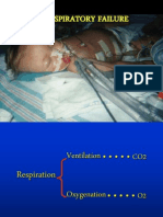 Acute Respiratory Failure