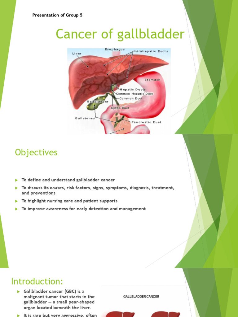 Understanding Gallbladder Cancer | PDF | Gallbladder | Liver