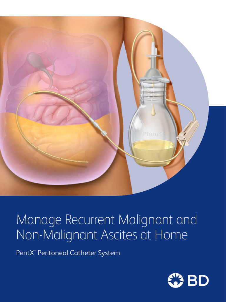 Home Management of Ascites with PeritX™ | PDF | Clinical Medicine ...