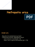 Nefropatia Urica