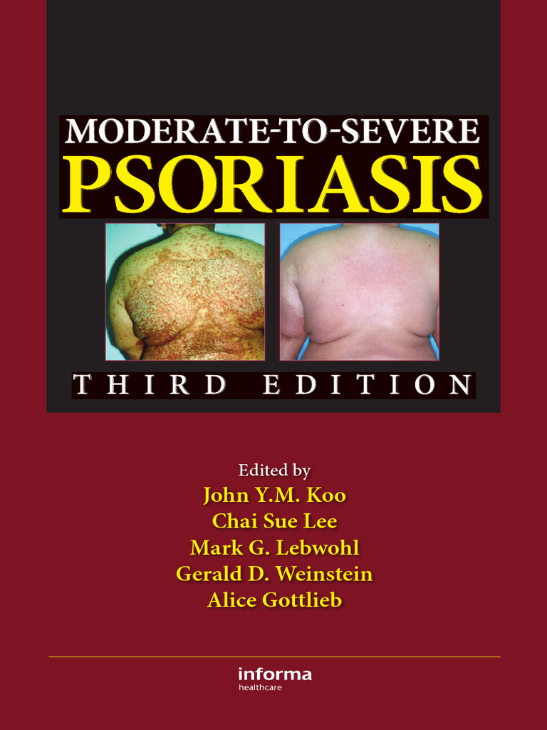 Comprehensive Guide to Psoriasis Care | PDF | Psoriasis | Twin