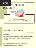 Download Breech Delivery by Febriendo Vanni Dwi Jayanti SN97612504 doc pdf