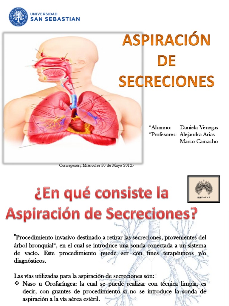 Aspiración de secreciones Dannii Venegas M.