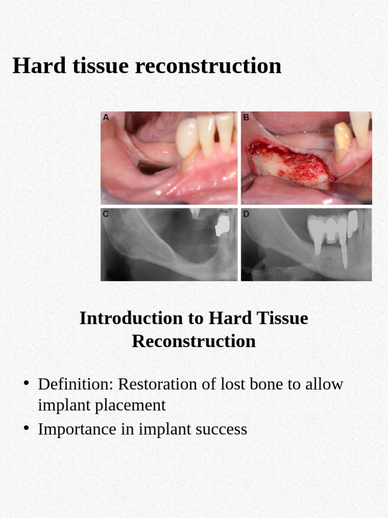 18053b - Hard Tissue Reconstruction | PDF