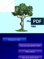 fracturasdetibia-110421114736-phpapp02