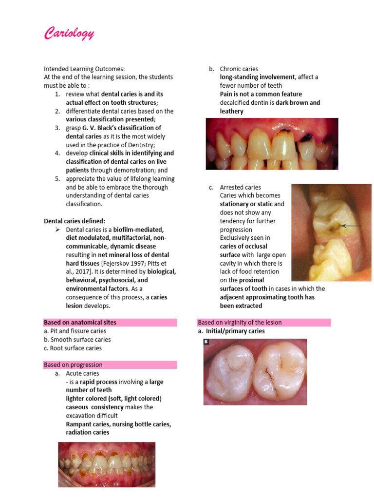 Dental Caries Classification Guide | PDF | Dental Anatomy | Mouth
