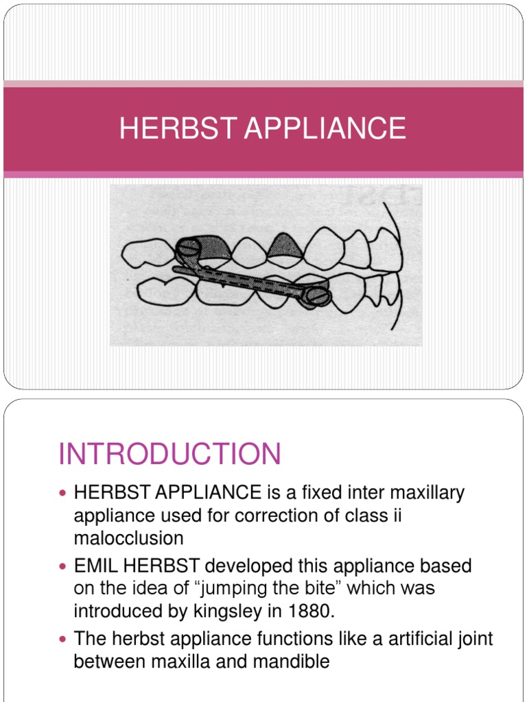 Herbst Appliance Ppt Dentistry Branches Mouth