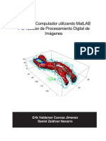 Procesamiento de Imagenes Con Matlab