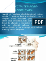 Disfunctia Dureroasa Temporo-Mandibulara