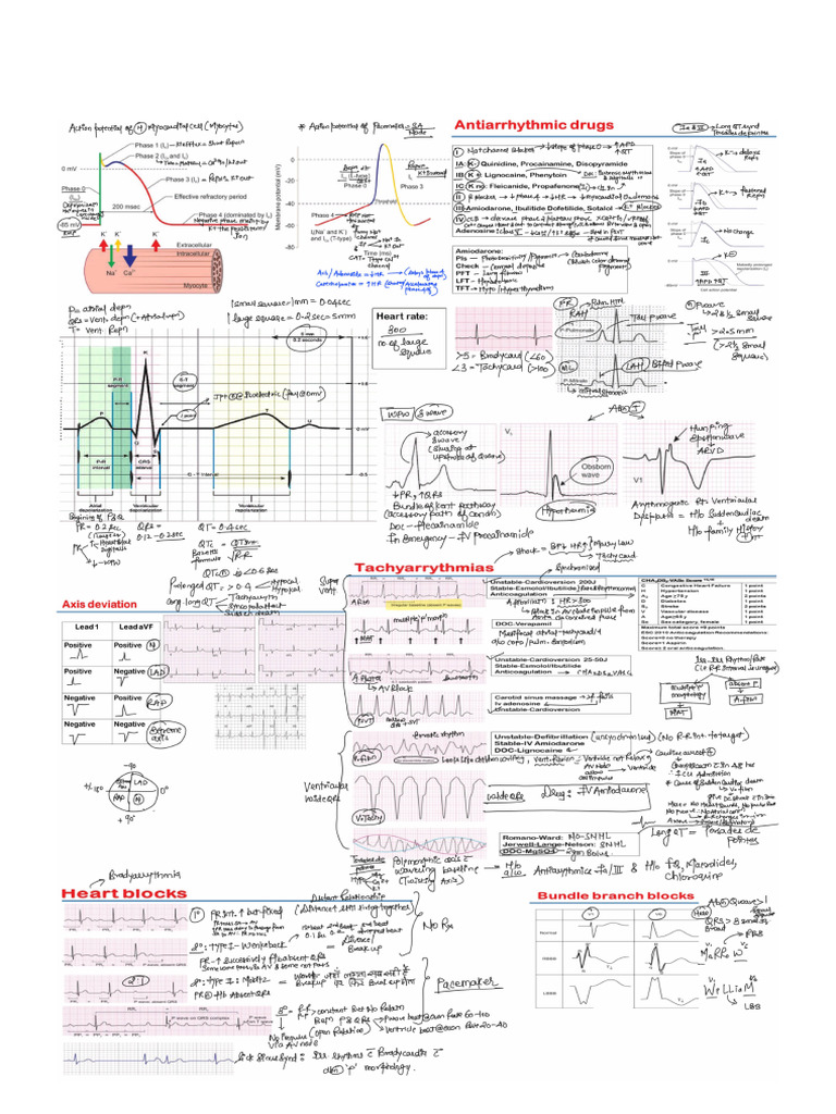 Ecg in Two Pages | PDF