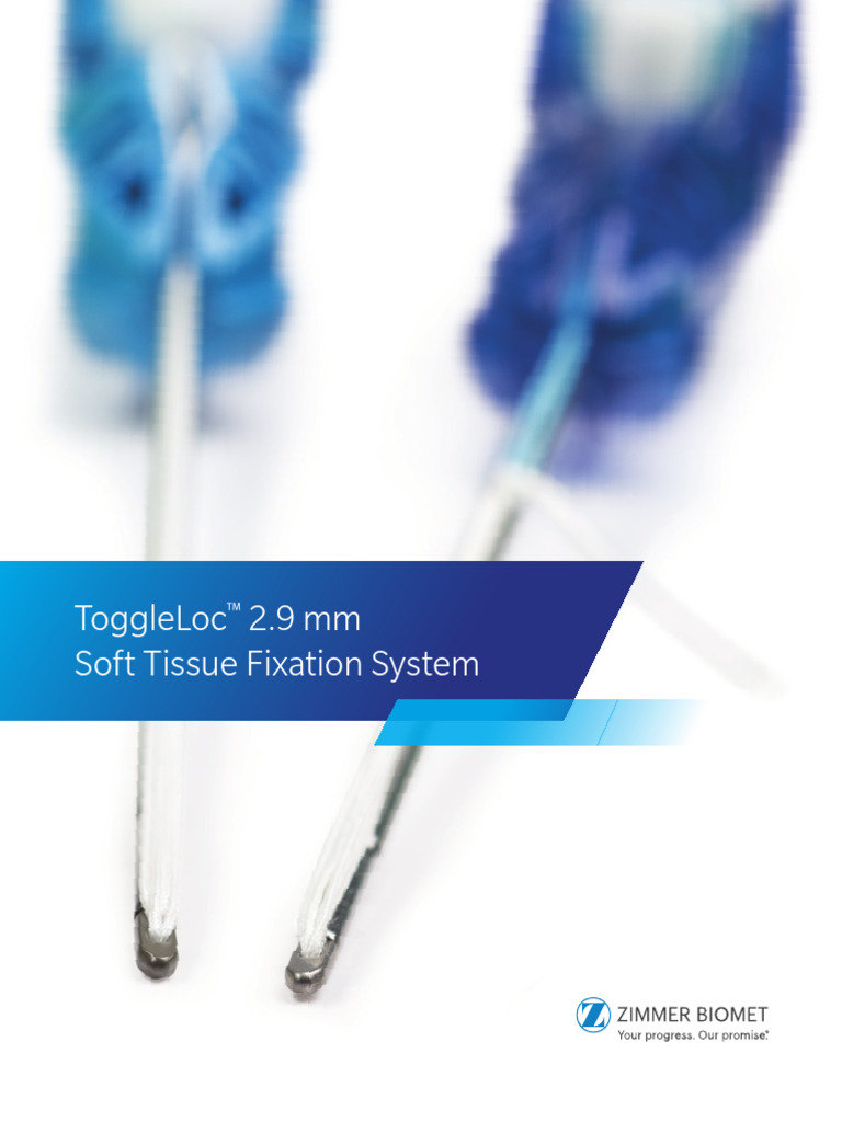 ToggleLoc 2.9 mm Soft Tissue Fixation | PDF | Dental Implant | Joints
