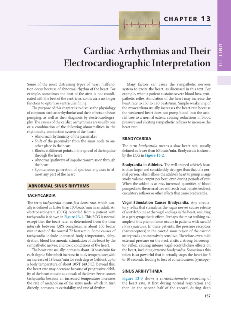 Understanding Cardiac Arrhythmias | PDF | Heart | Electrocardiography