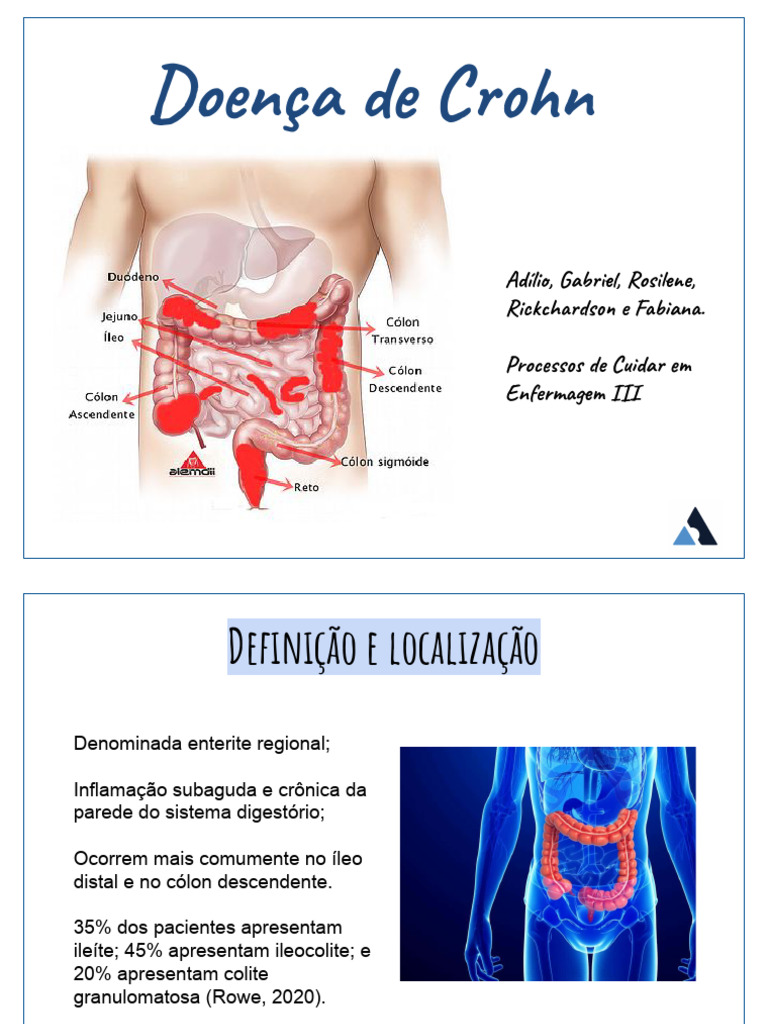 Entendendo a Doença de Crohn: Sintomas e Cuidados | PDF | Doença de ...