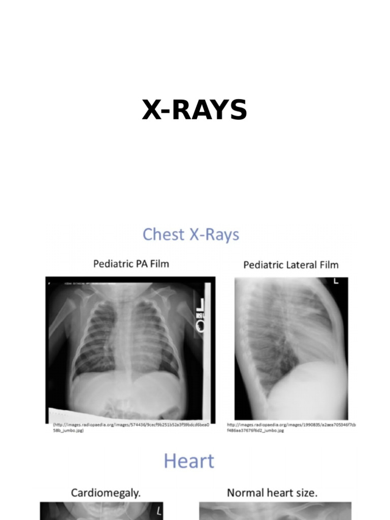 New Xrays | PDF