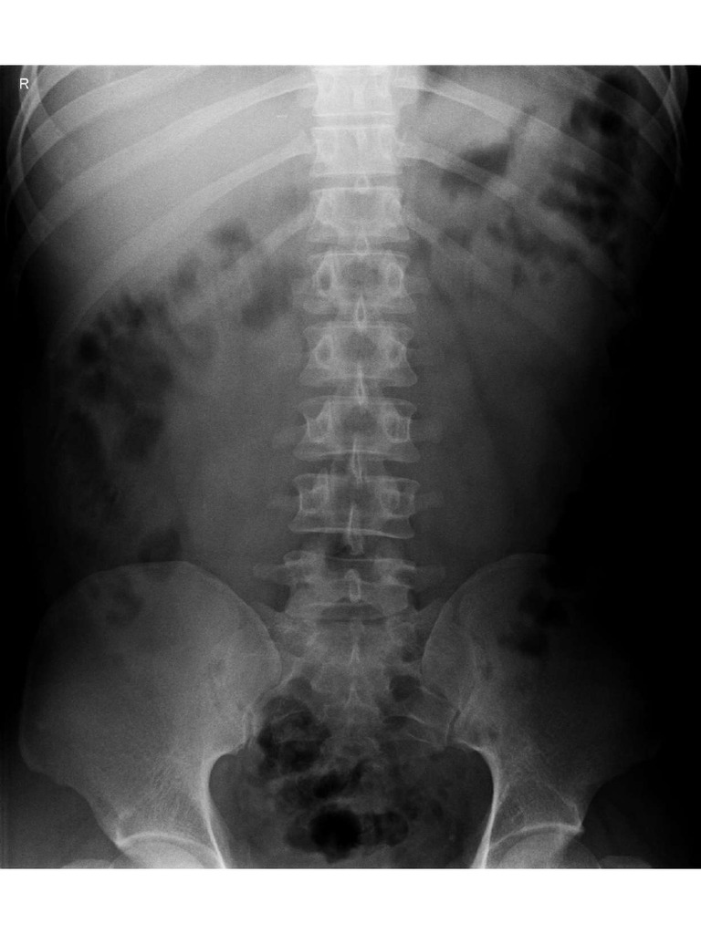 Abdullah X RAY | PDF