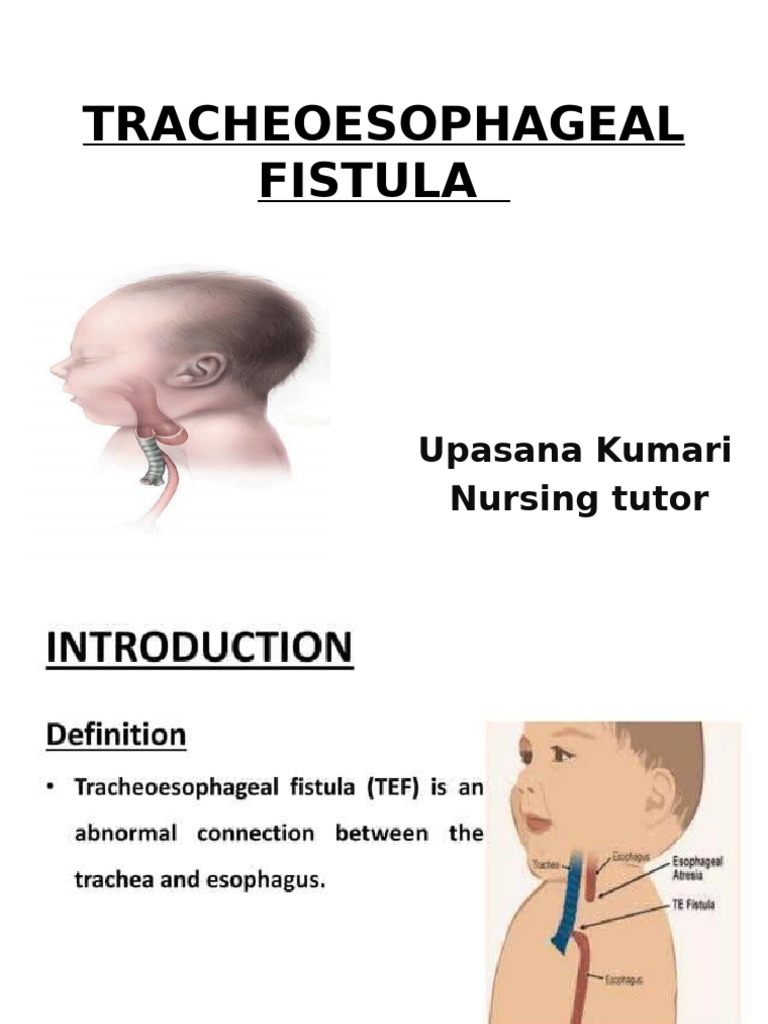 Tracheoesophageal Fistula: Upasana Kumari Nursing Tutor | PDF