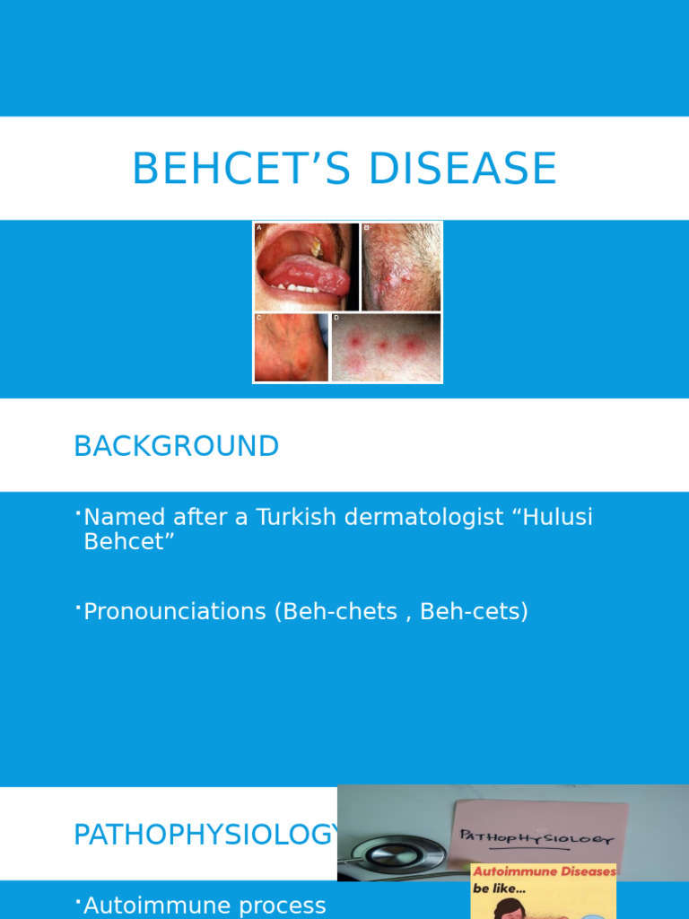 Understanding Behcet's Disease: Symptoms & Treatment | PDF