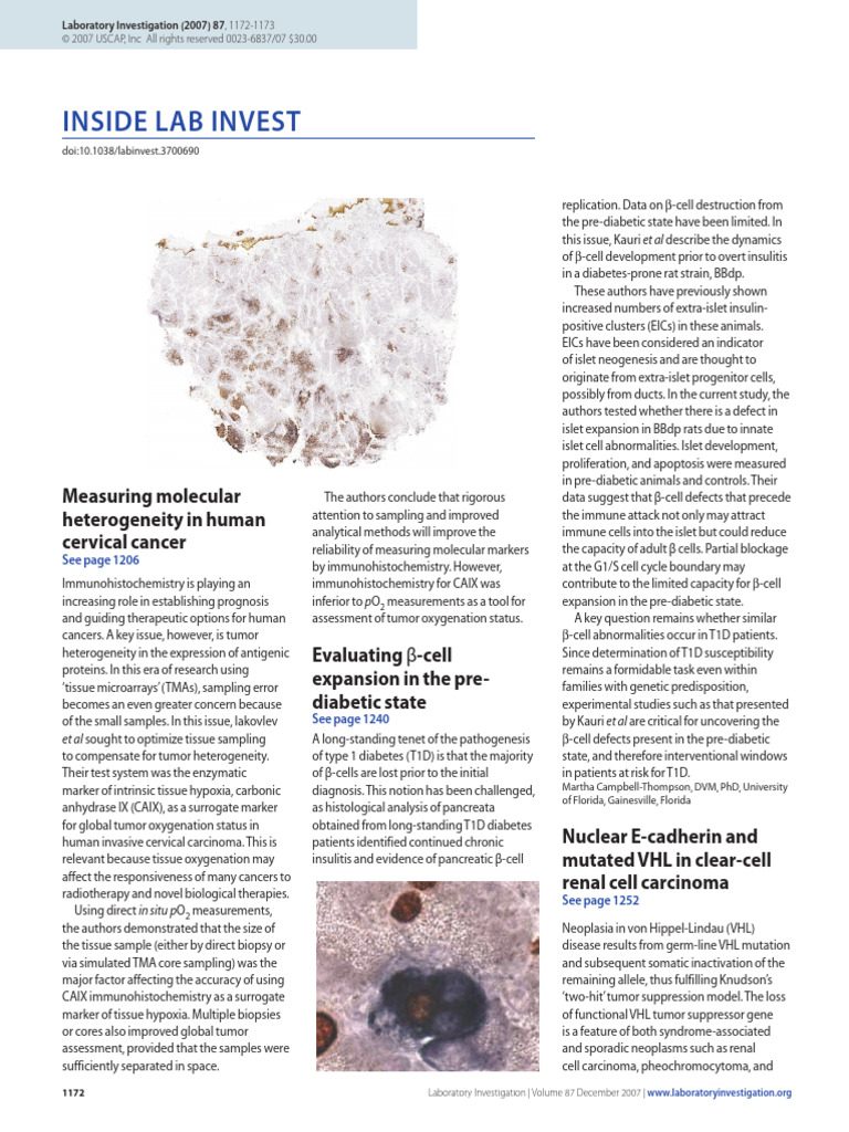 Molecular Heterogeneity in Cervical Cancer | PDF | Inflammation | Biopsy