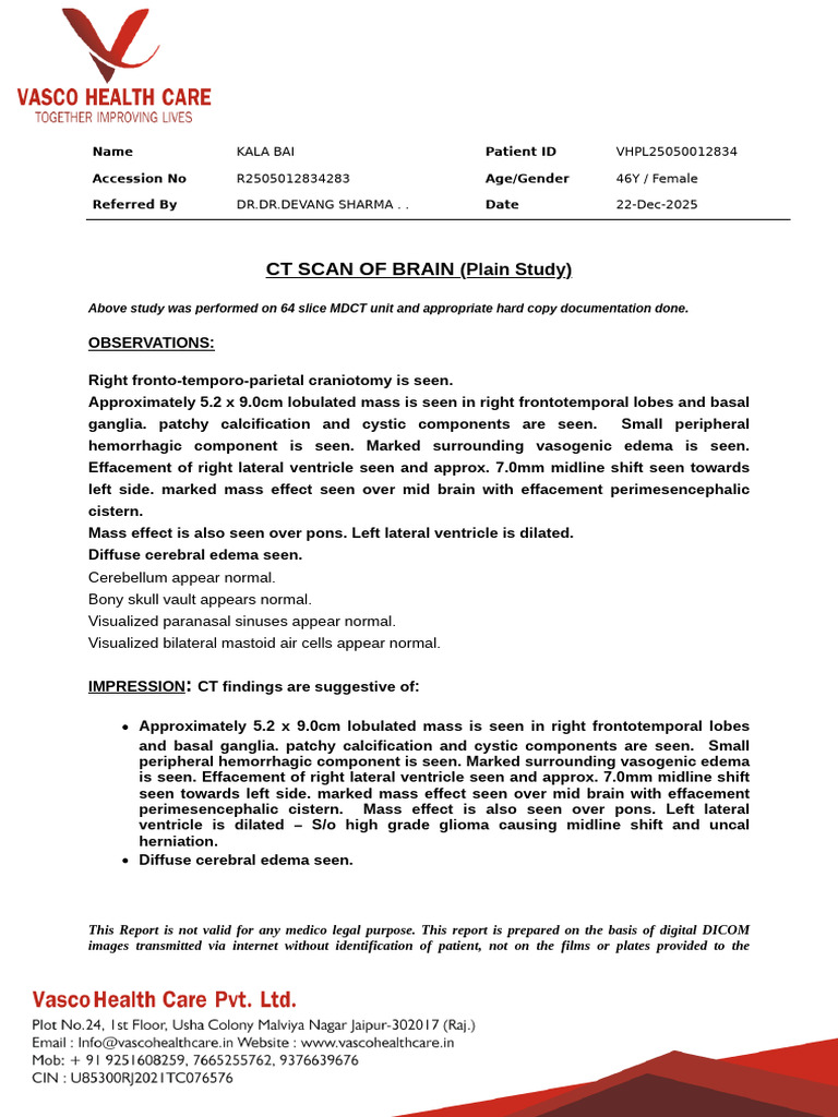 CT Brain Scan Report: High-Grade Glioma | PDF | Brain | Nervous System