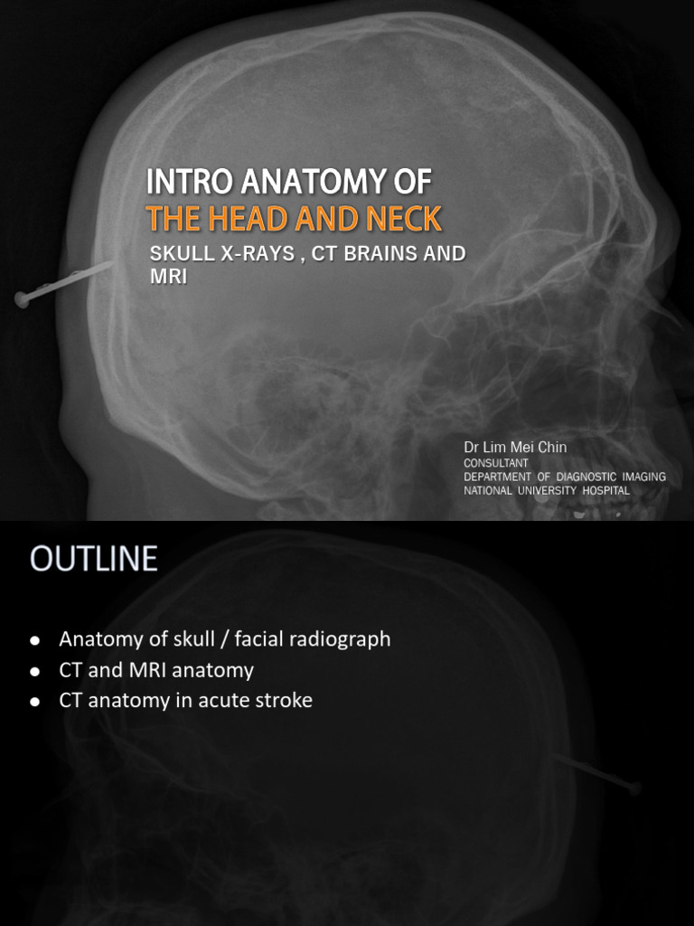 Skull Imaging: X-Rays, CT, MRI Insights | PDF | Skull | Primate Anatomy