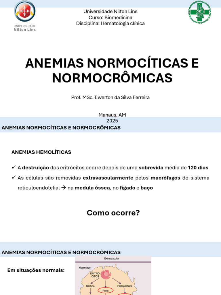 Aula 6 Anemias Normocíticas e Normocrômicas | PDF | Anemia ...