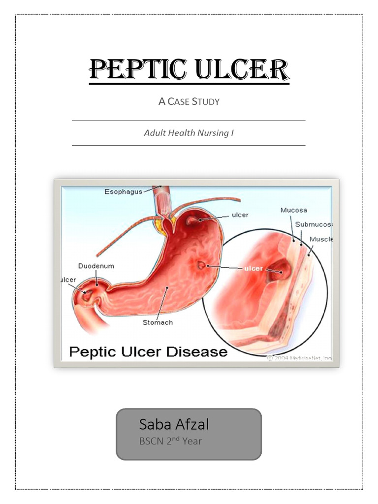 Peptic Ulcer Case Study Analysis | PDF | Pain | Nursing