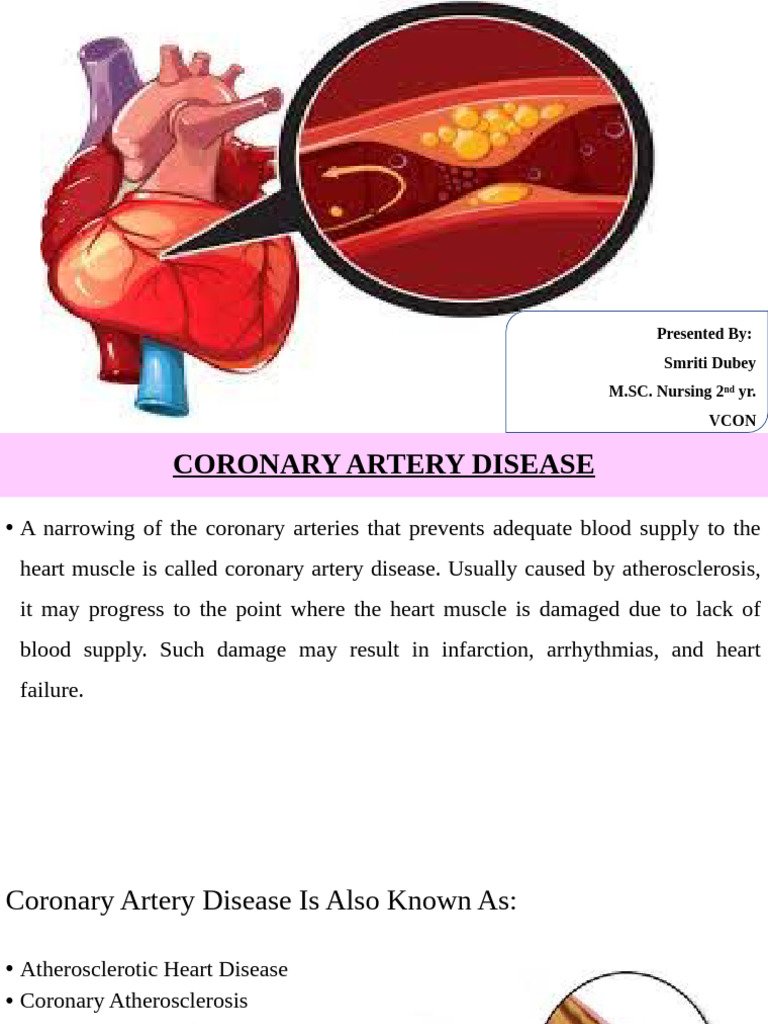 Understanding Coronary Artery Disease | PDF | Myocardial Infarction ...