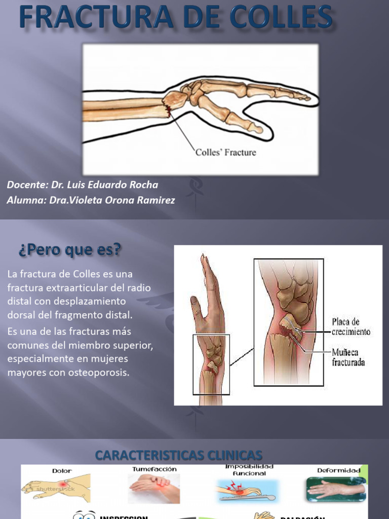 Fractura de Colles Sesiones | PDF | Traumatologia | Especialidades Medicas